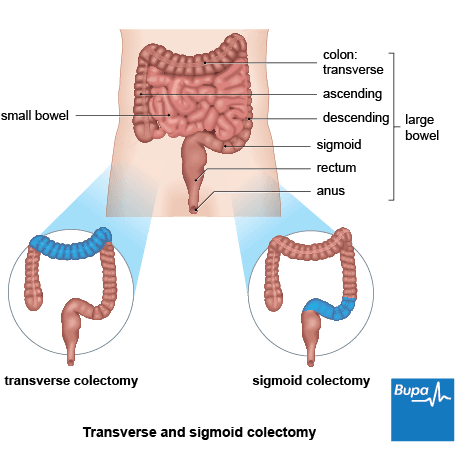 diseasesAtoZ